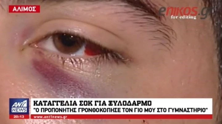 Καταγγελία σοκ για ξυλοδαρμό σε γυμναστήριο – Προπονητής γρονθοκόπησε τον γιο μου γιατί διαφώνησαν για…μία άσκηση (βίντεο)